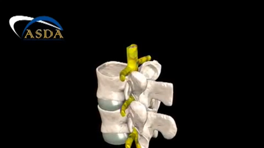 Non-Surgical-Spinal-Decompression-3D-Animation_20181003024502